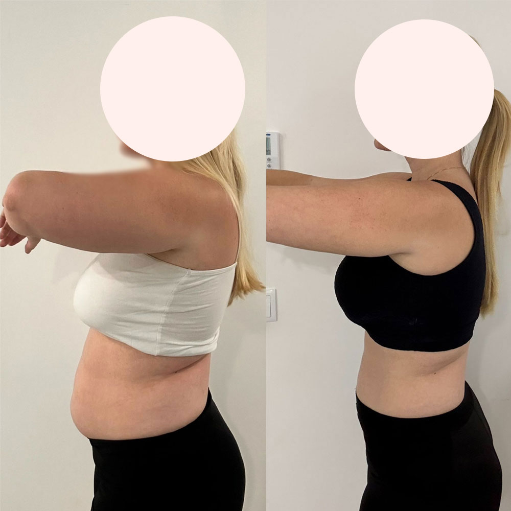 Transformation 1