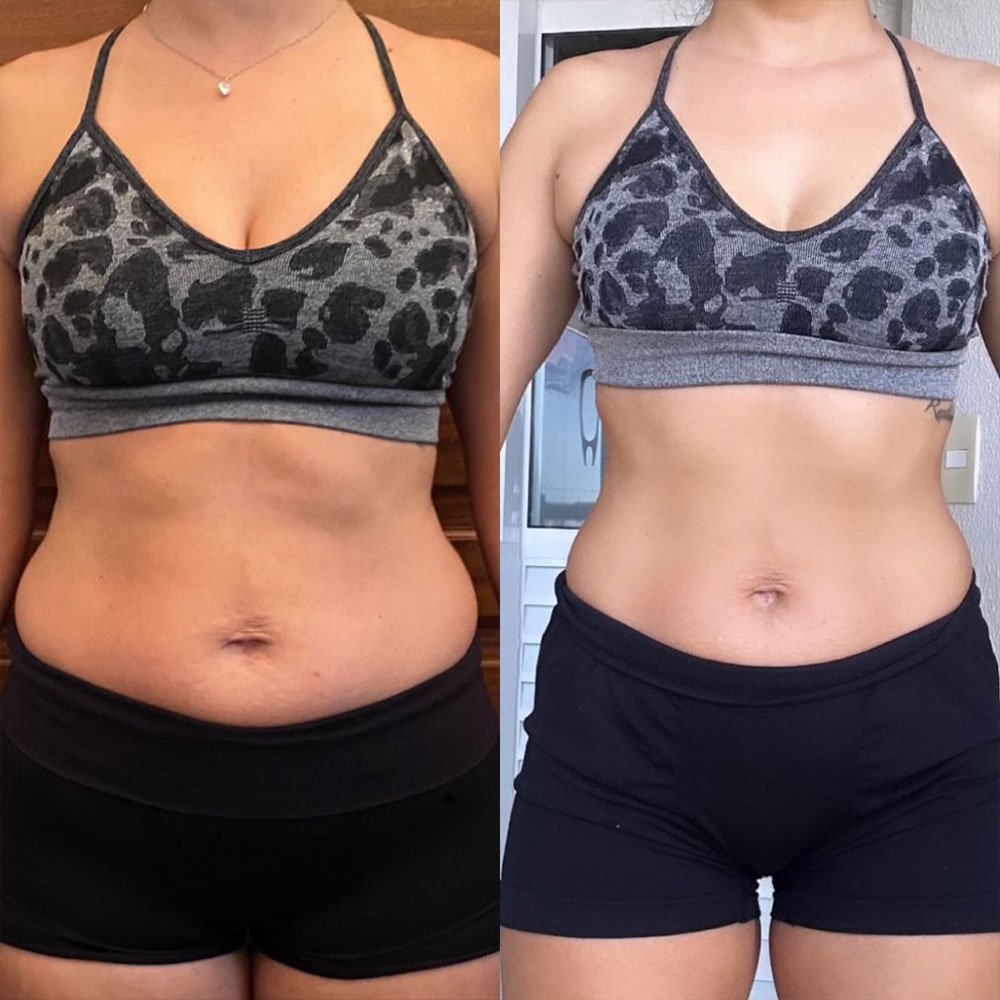 Transformation 10