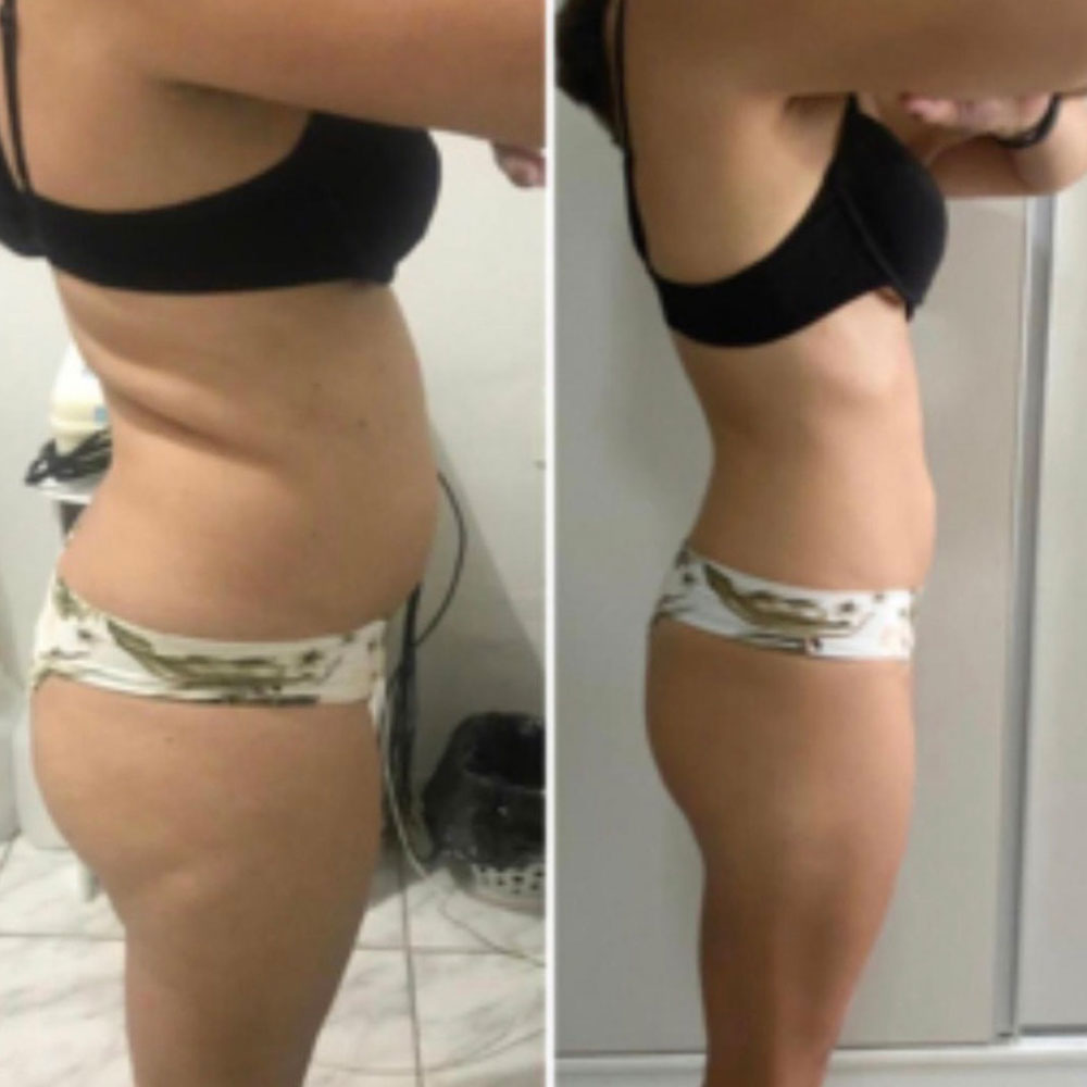 Transformation 7